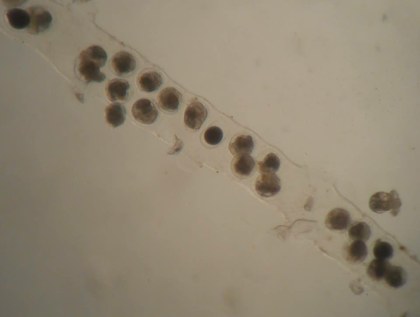 Dalila. veleger_recien naitreSpugilis_from labo.jpg